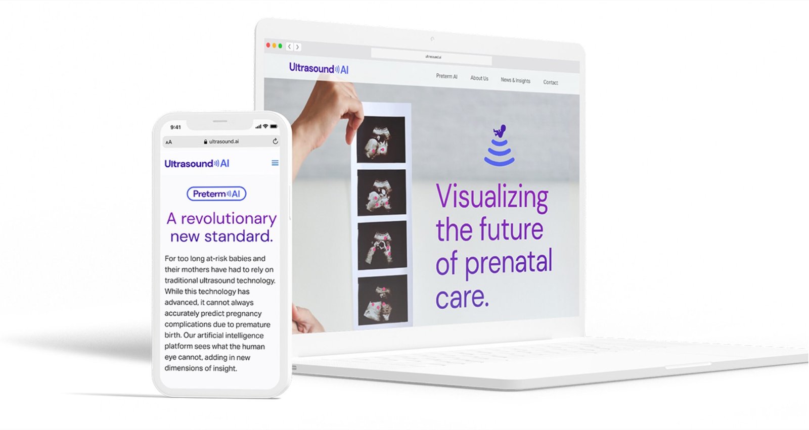 Ultrasound AI website shown on laptop and mobile, with the headline: visualizing the future of prenatal care